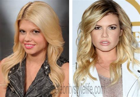 chanel west coast before plastic surgery|chanel west coast cosmetic surgery.